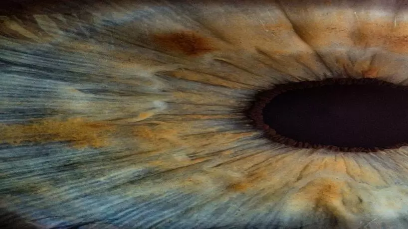 computer vision