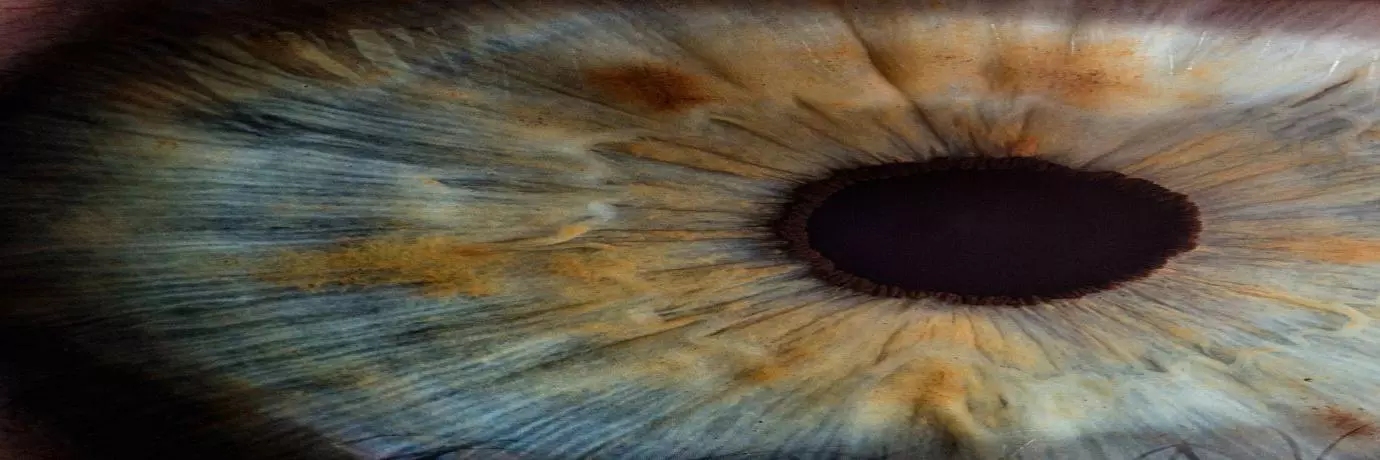 computer vision